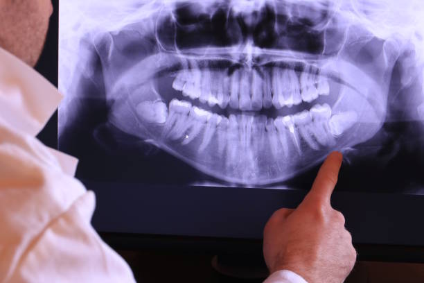 Best Emergency Root Canal Therapy in Vaiden, MS